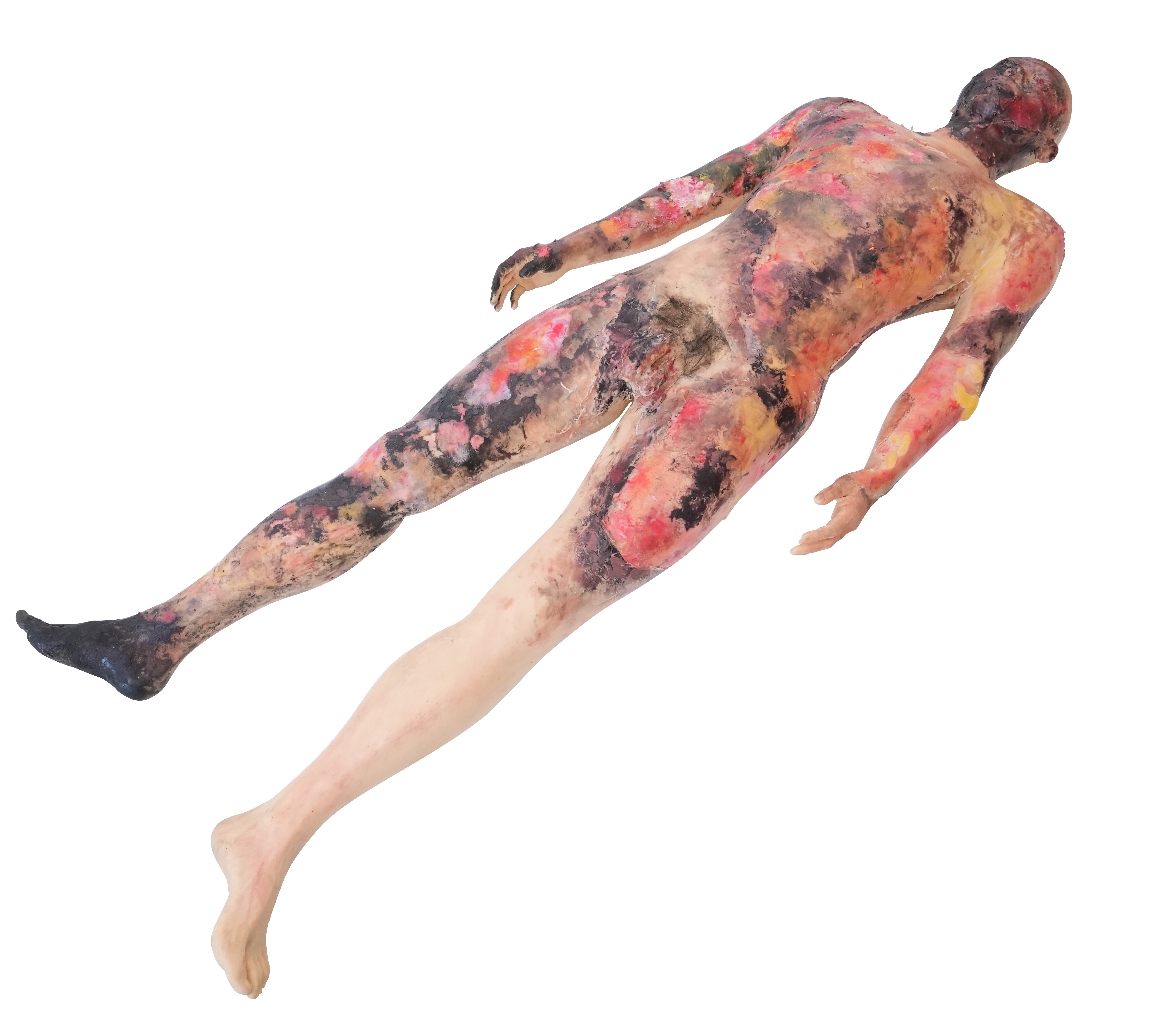 Full-body Burn Assessment Manikin